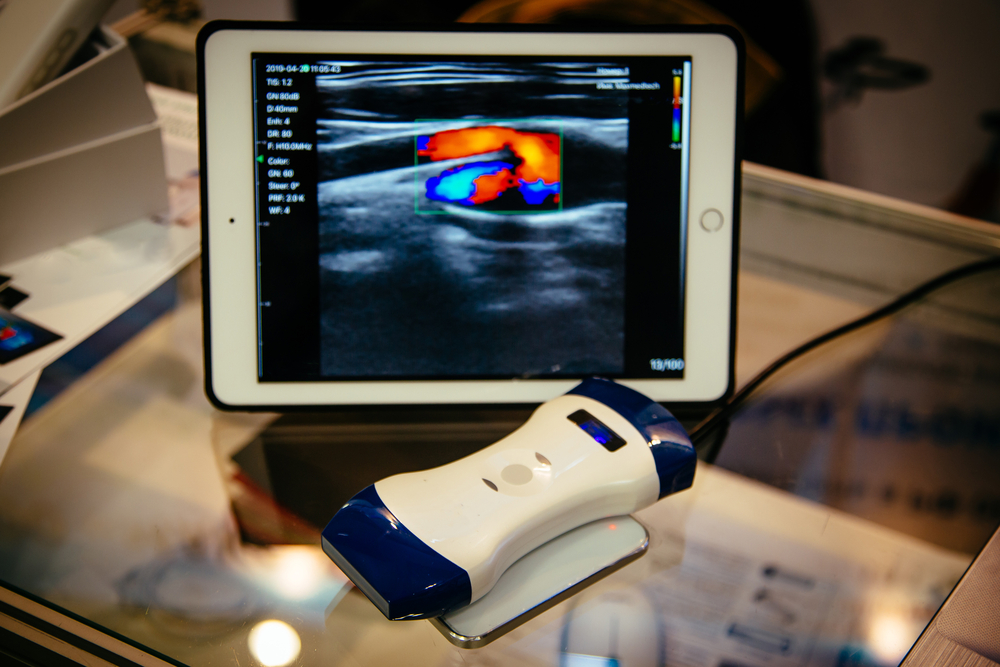 portable ultrasound